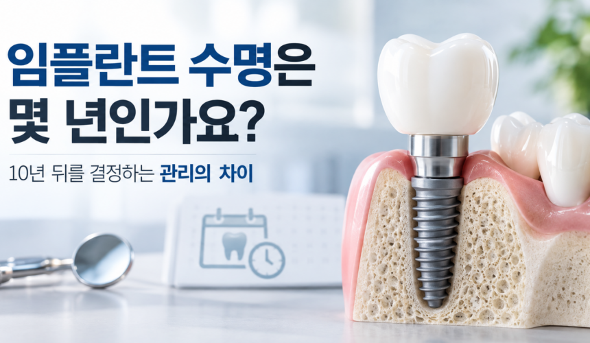임플란트 수명은 몇 년인가요? 10년 뒤를 결정하는 관리의 차이